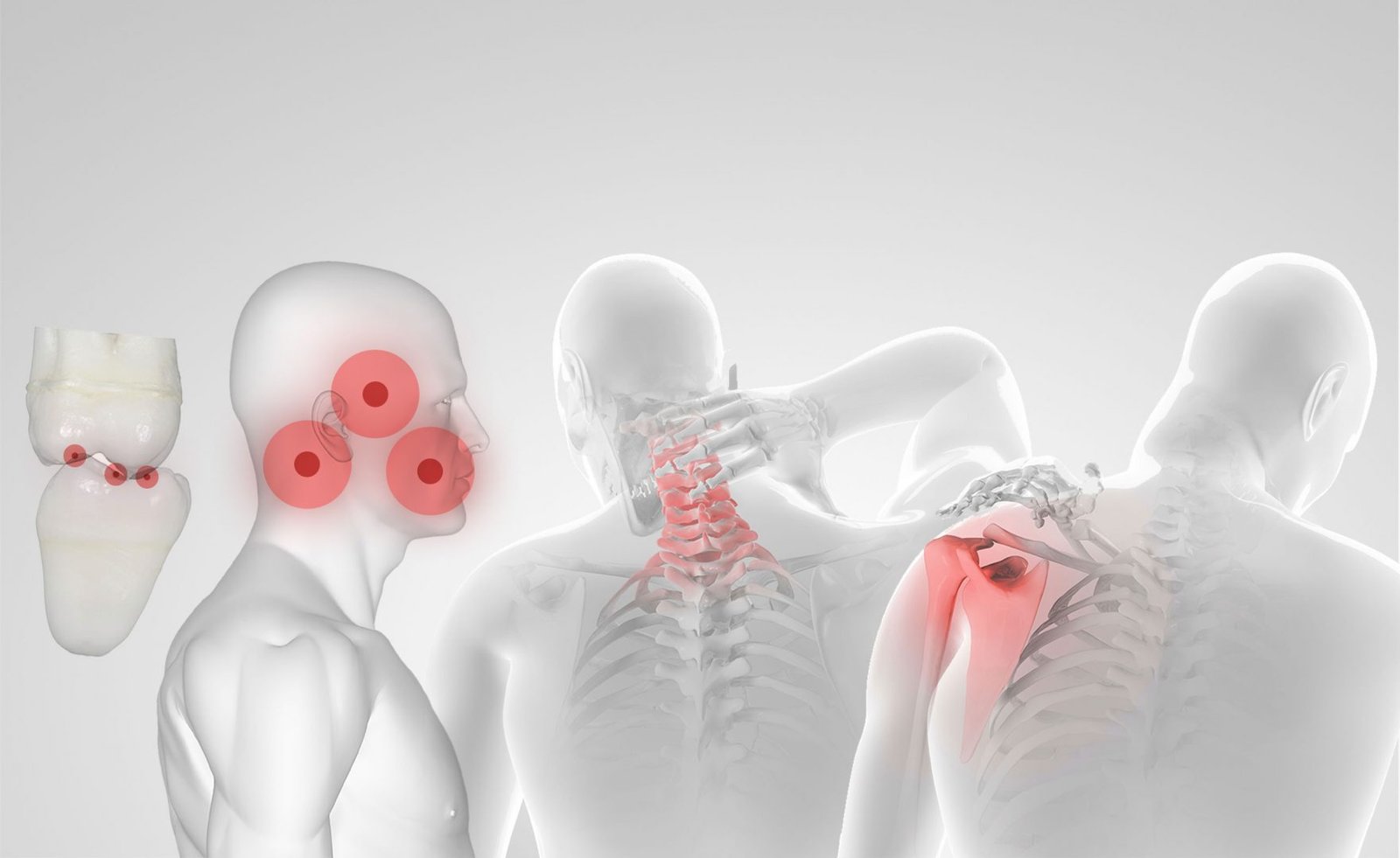 Σύγκλειση δοντιών