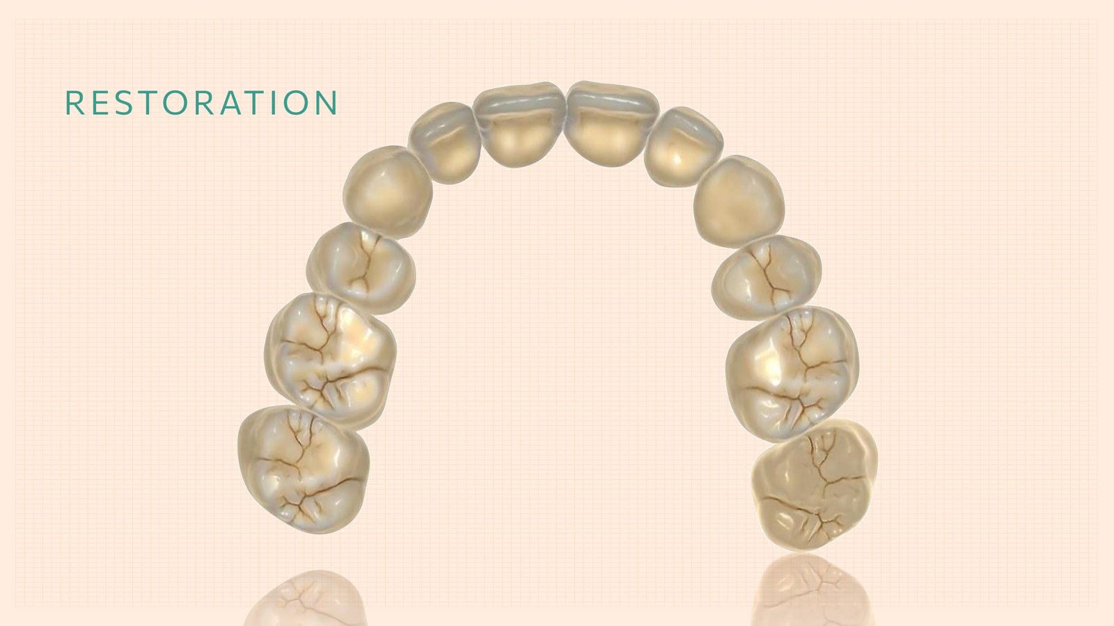 Kalotas-implants-Restoration